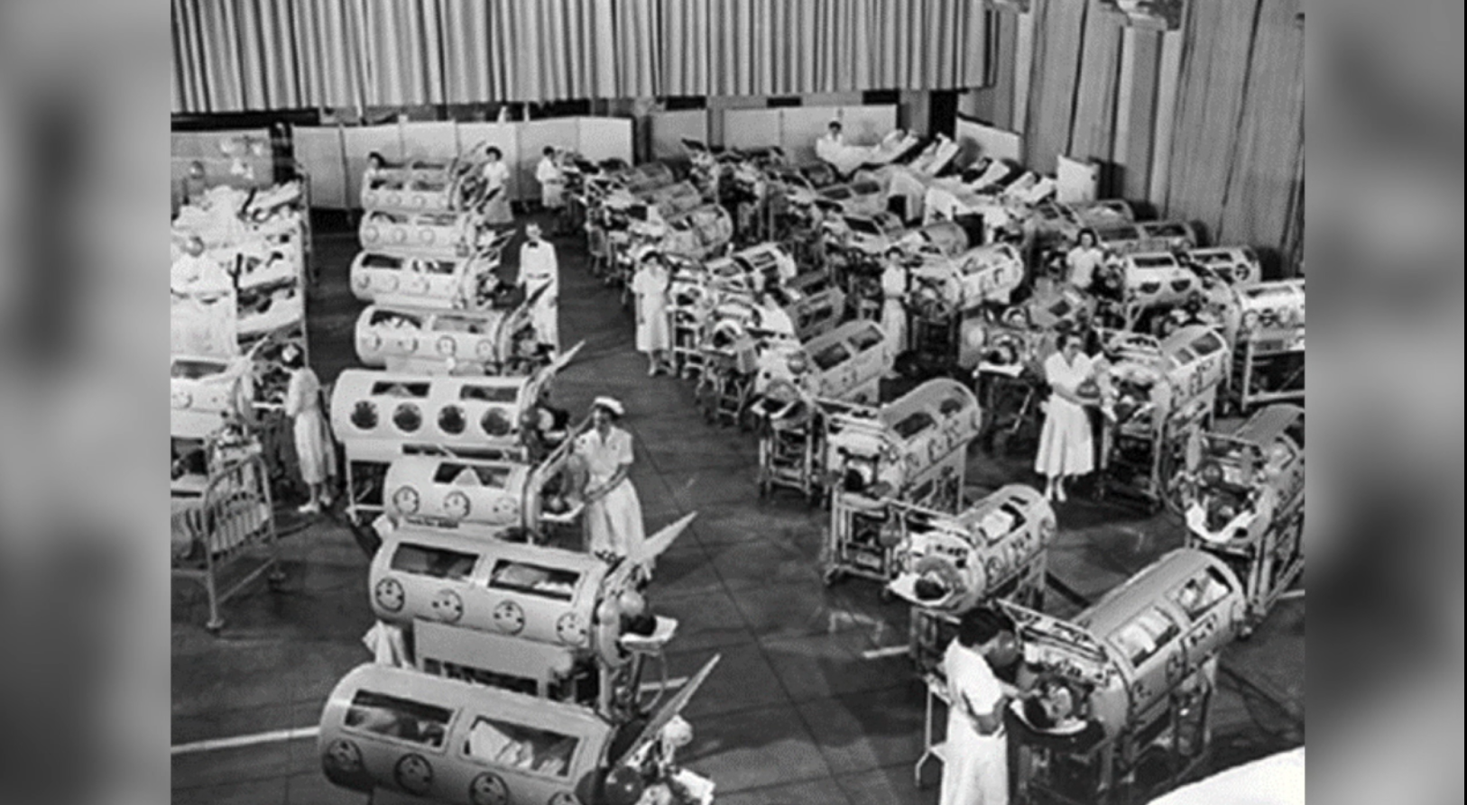 polio iron lung